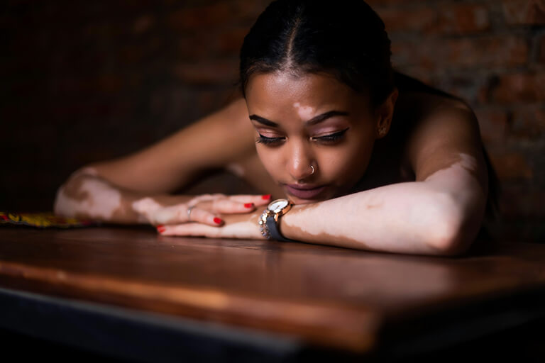 A woman resting her chin on her arms at a table